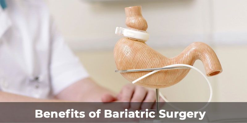 Bariatric Surgery Hospital in India